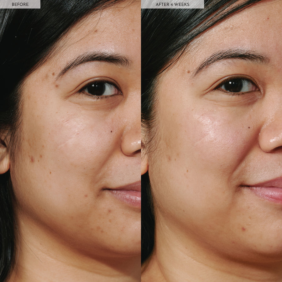 gocce di rugiada alla niacinamide watermelon glow