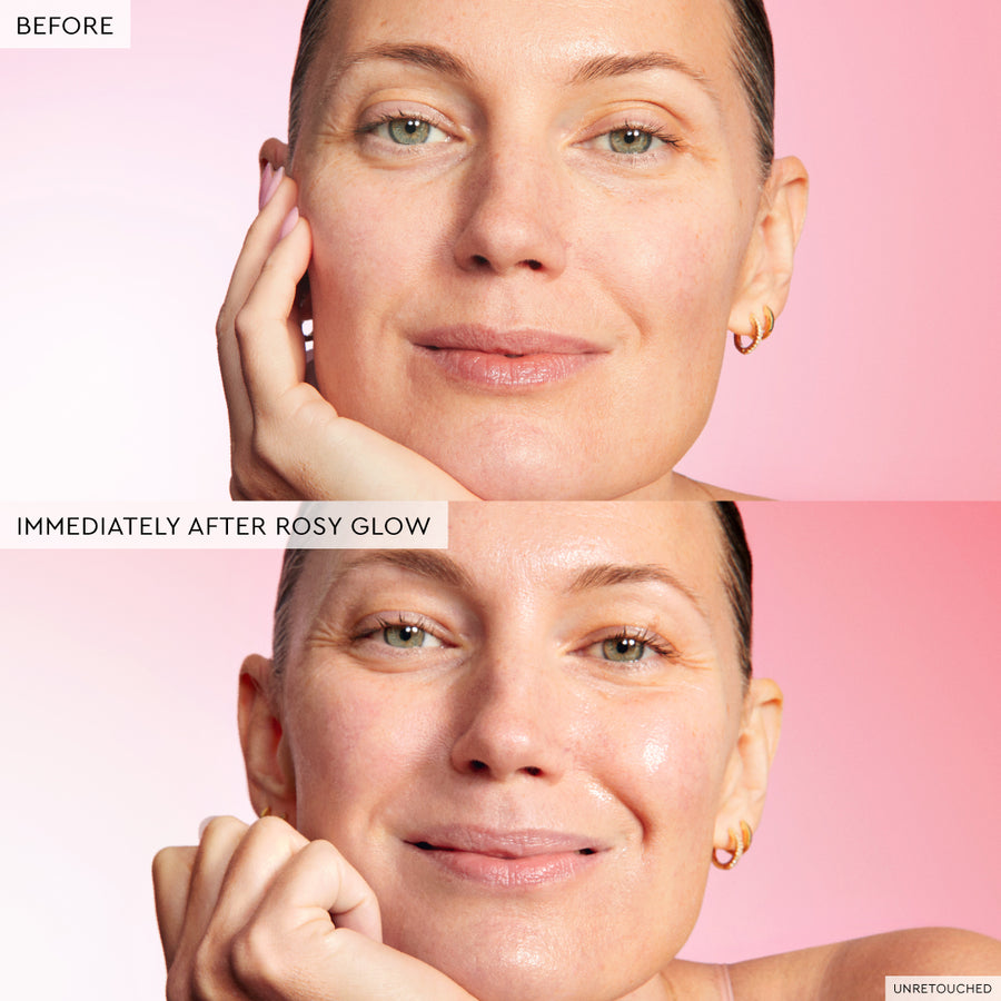 gocce di niacinamide watermelon glow