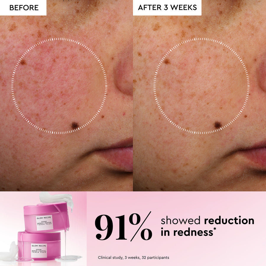 dischetti tonificanti coreani pdrn repair soothe