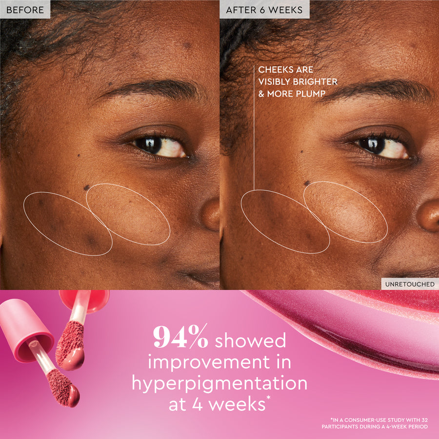 watermelon glow niacinamide dewy flush